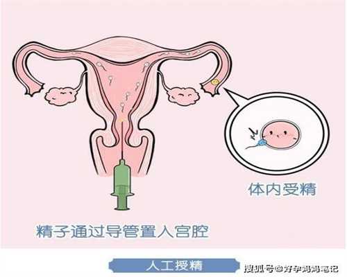 北京公立医院供卵要求-代孕哪里医院较